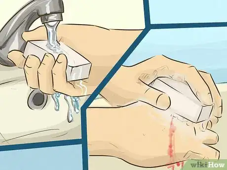 Imagen titulada Stop Bleeding Step 12