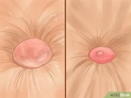 Imagen titulada Recognize Skin Cancer in Cats Step 6