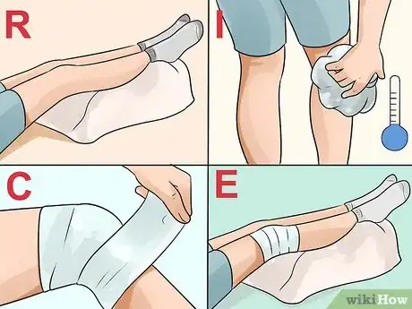 Imagen titulada Get Rid of a Cyst Step 5