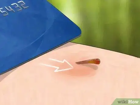 Imagen titulada Get a Stinger Out Step 2