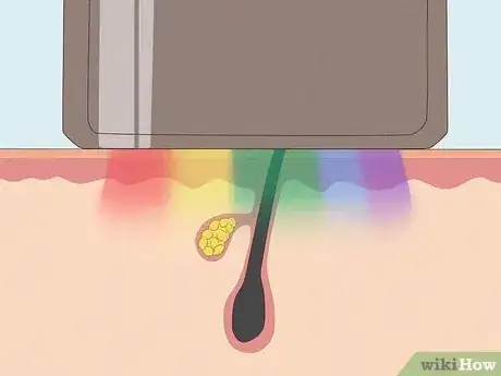 Imagen titulada Remove Pubic Hair Permanently Step 4