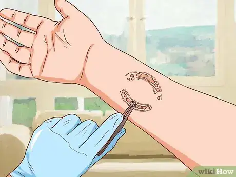 Imagen titulada Treat a Human Bite Step 9