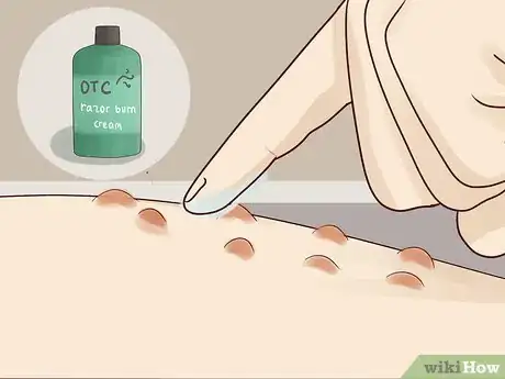 Imagen titulada Prevent Razor Burn on Your Private Parts Step 10