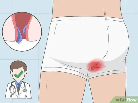 Imagen titulada Recognize Colon Cancer Symptoms Step 6