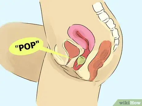 Imagen titulada Use a Menstrual Cup Step 9