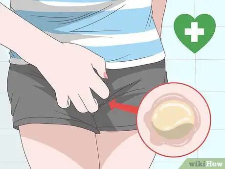 Imagen titulada Reduce Vaginal Discharge Step 13