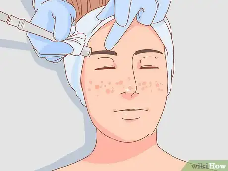 Imagen titulada Get Rid of Dark Spots Step 12