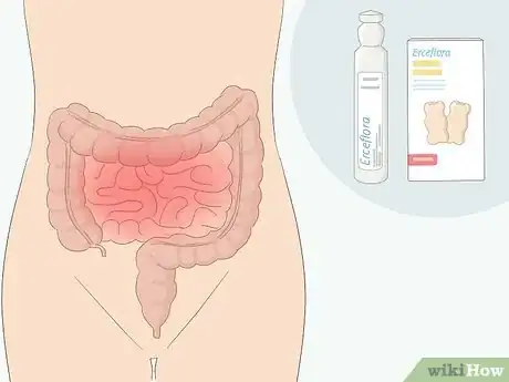 Imagen titulada Take Erceflora Step 1