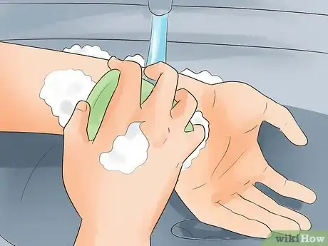 Imagen titulada Treat a Small Burn Step 7