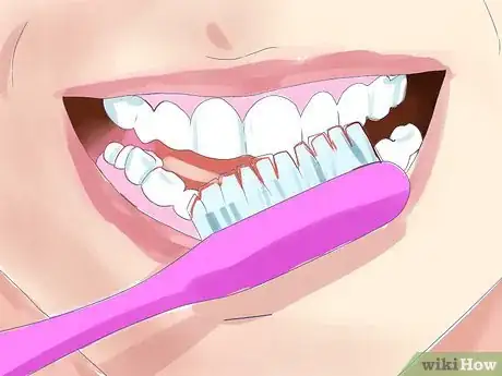 Imagen titulada Bite Someone's Lip Step 13