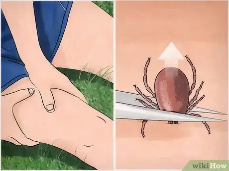 Imagen titulada Get Rid of Ticks Around Your Home Step 16