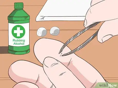 Imagen titulada Remove a Deep Splinter Step 1
