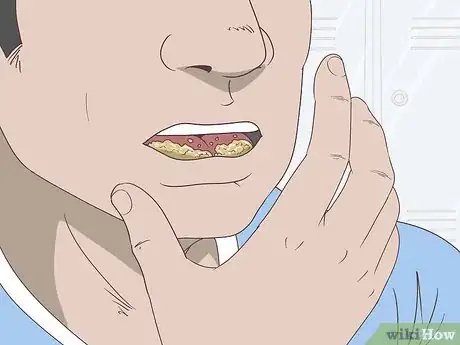 Imagen titulada Stop Swallowing Air Step 4