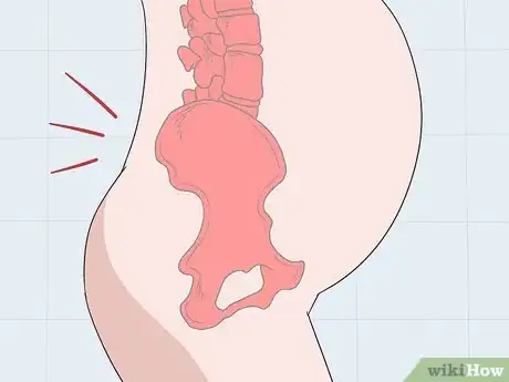Imagen titulada Tell the Difference Between a Period and a Miscarriage Step 7