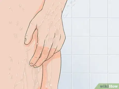 Imagen titulada Clean a Circumcision Step 10