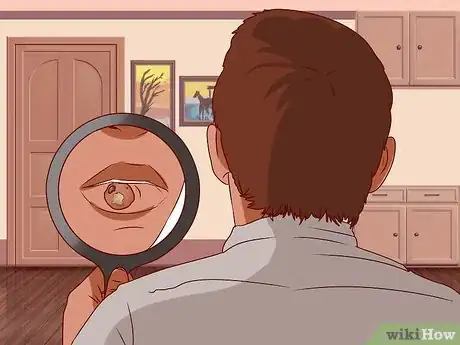 Imagen titulada Tell Signs of Sexual Infection from Penis Step 8