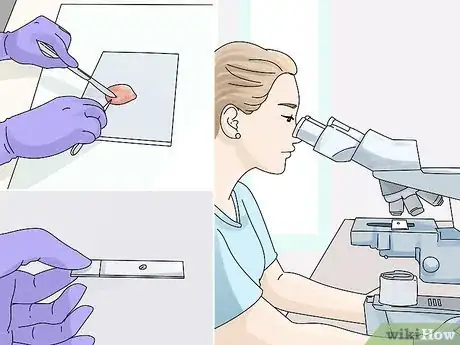Imagen titulada Diagnose and Treat Benign Tumors in Cats Step 8