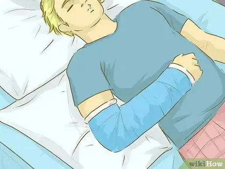 Imagen titulada Have Fun With a Broken Arm Step 15