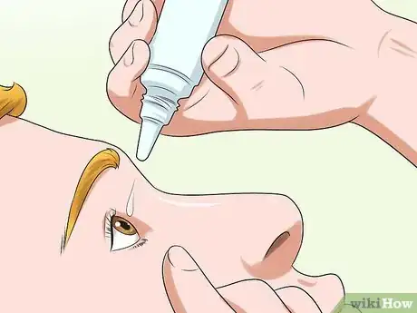 Imagen titulada Clear Red Eyes Step 2