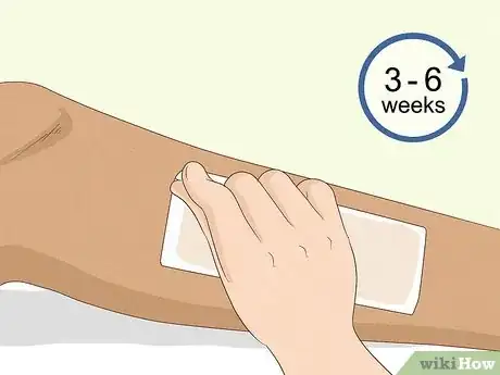 Imagen titulada Prevent Ingrown Hairs After Waxing Using Home Remedies Step 11