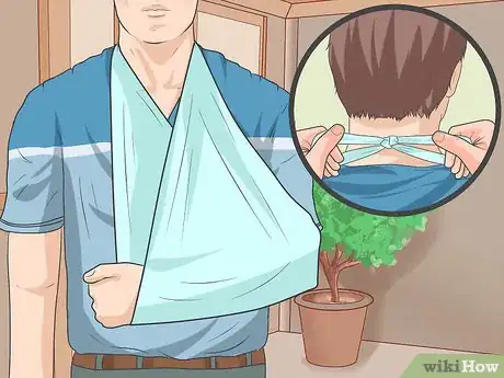 Imagen titulada Tell if a Fall Broke Bones Without an X Ray Step 12