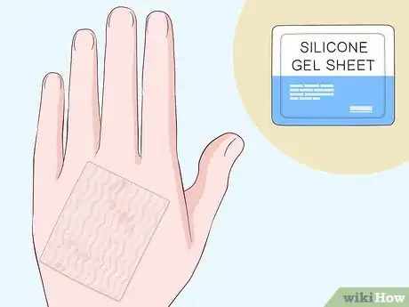 Imagen titulada Heal Scabies Scars Step 3