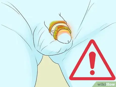 Imagen titulada Clean a Circumcision Step 14