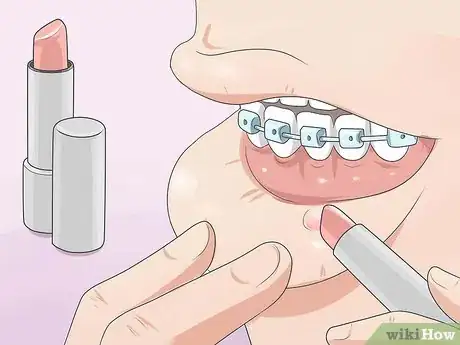 Imagen titulada Make Your Braces Hurt Less Step 10