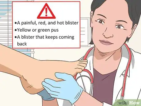 Imagen titulada Treat a Foot Blister Step 12