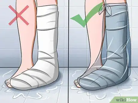 Imagen titulada Heal Broken Bones Step 6