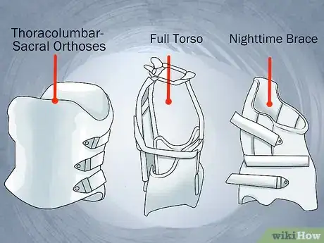 Imagen titulada Reduce Scoliosis Curvature Step 2
