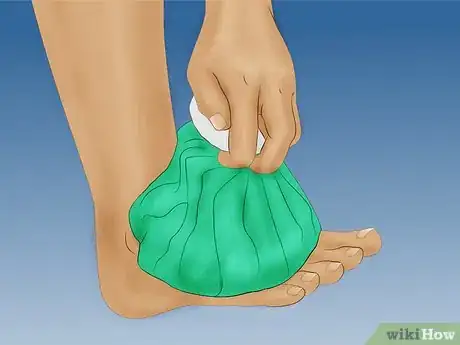 Imagen titulada Strengthen Your Ankle After a Sprain Step 3