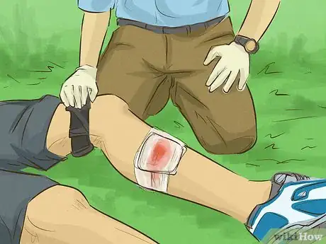Imagen titulada Stop Bleeding Step 22