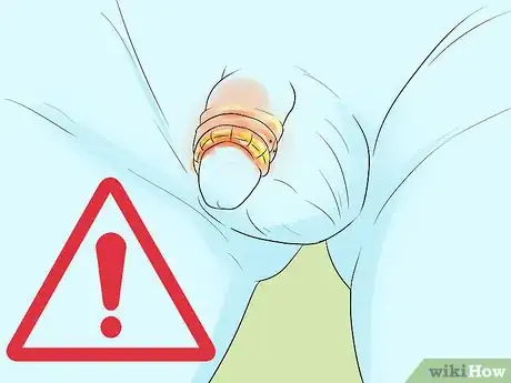 Imagen titulada Clean a Circumcision Step 13