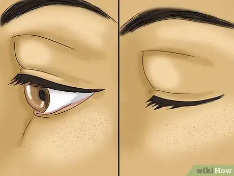 Imagen titulada Get Dirt Out of Your Eye Step 1