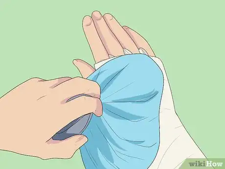 Imagen titulada Splint a Fractured Hand Step 14