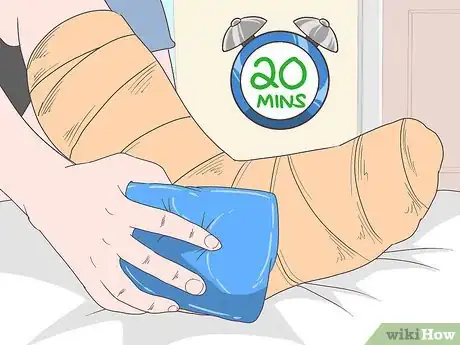 Imagen titulada Reduce Swelling After Surgery Step 2