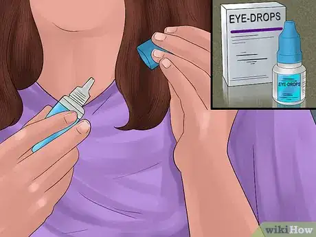 Imagen titulada Apply Eye Drops in a Parrot's Eye Step 2