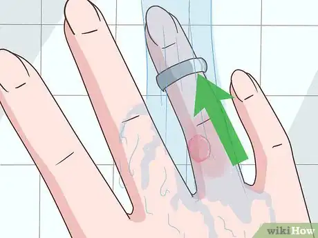 Imagen titulada Treat a Blistering Burn on Your Finger Step 2