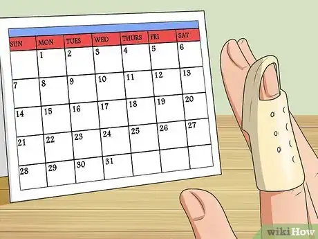 Imagen titulada Splint Trigger Finger Step 17