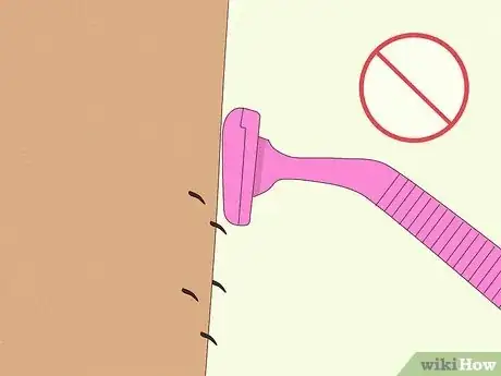Imagen titulada Prevent Ingrown Hairs After Waxing Using Home Remedies Step 10