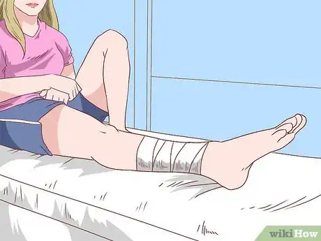 Imagen titulada Treat a Pulled Oblique Muscle Step 4