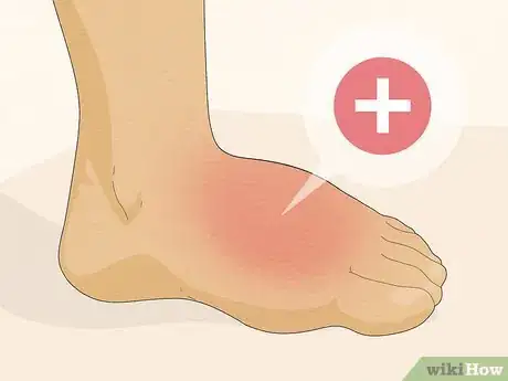 Imagen titulada Deal with Foot Cramps Step 16