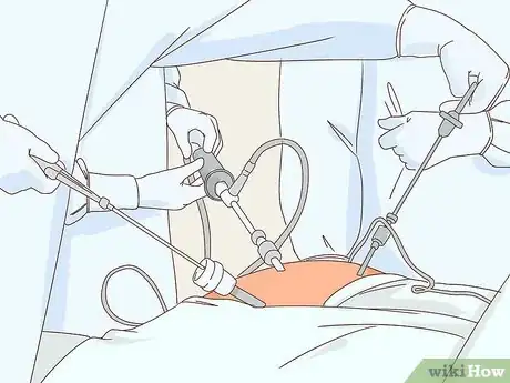 Imagen titulada Lose Pancreas Fat Step 11