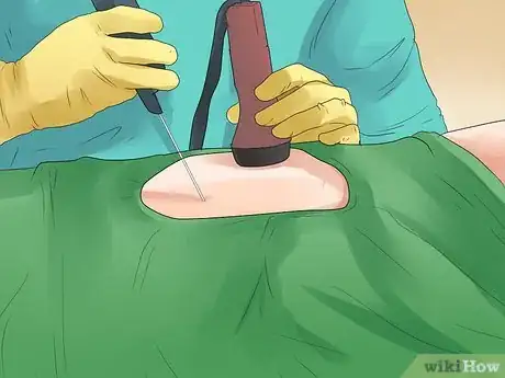 Imagen titulada Deal with Gout in Ankles with FSGS Step 16