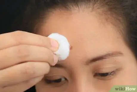 Imagen titulada Remove Deep Facial Wrinkles Step 3