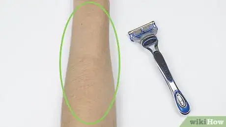 Imagen titulada Strap an Elbow Step 3