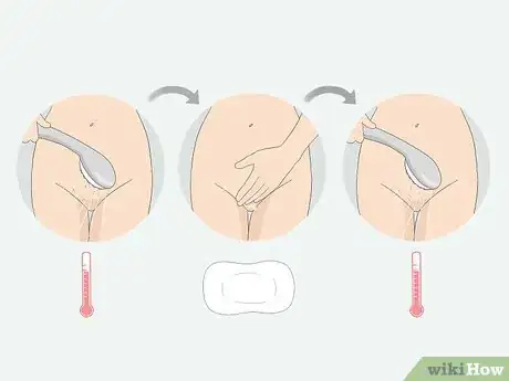 Imagen titulada Get Rid of Ingrown Pubic Hair Step 12