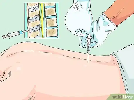 Imagen titulada Diagnose Meningitis Step 7