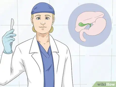 Imagen titulada Pass Gallstones Naturally Step 16